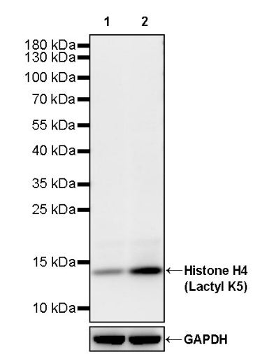 Histone H4 (Lactyl K5) Recombinant Rabbit mAb (S-3220-73)