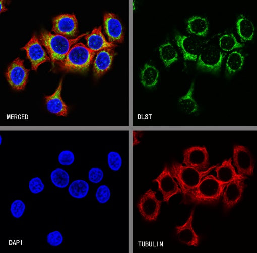 DLST Recombinant Rabbit mAb (S-2283-10)