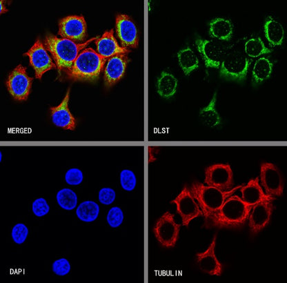 DLST Recombinant Rabbit mAb (S-2283-10)