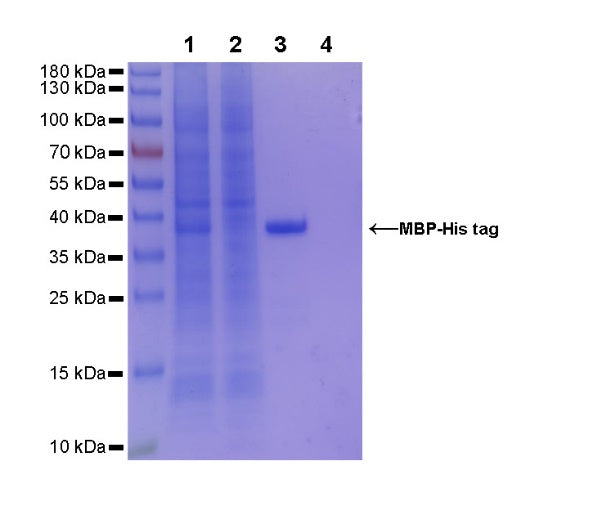 Rabbit Anti-His Tag (C-terminal) Magnetic Agarose