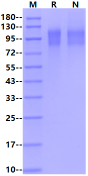 EBOV Envelope (subtype Zaire, strain Kikwit-95) Glycoprotein 1(GP1) His Tag Protein, Ebola virus