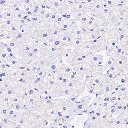 MUC5AC Recombinant Rabbit mAb, PBS Only (SDT-2630-23)