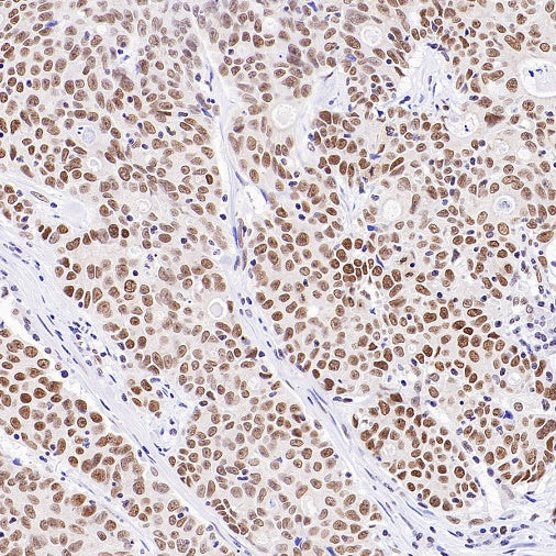 EHMT2/G9A Recombinant Rabbit mAb (S-4200)