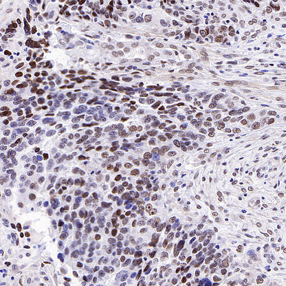 SMARCA3 Recombinant Rabbit mAb (S-3575-154)