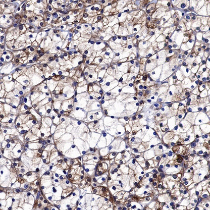 FTO Recombinant Rabbit mAb (S-1663-48)