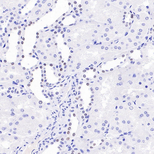 AP2α Recombinant Rabbit mAb (S-2376-7)