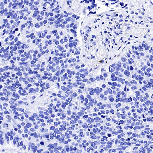 p63 Recombinant Rabbit mAb (SDT-054-137)