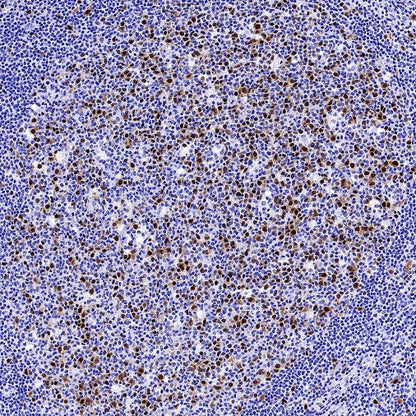 Cyclin A2 Recombinant Rabbit mAb (S-2554-2)