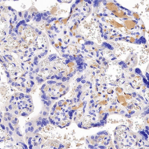 AAT Recombinant Rabbit mAb (S-943-37)