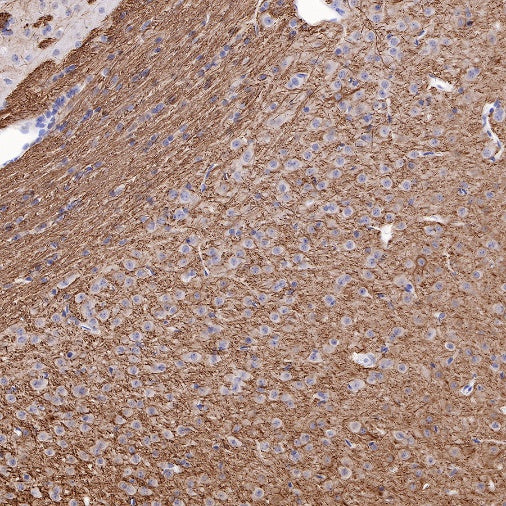 Neurofilament L Recombinant Rabbit mAb (S-635-214)