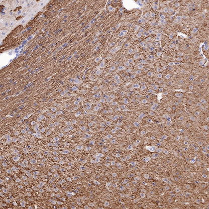 Neurofilament L Recombinant Rabbit mAb (S-635-214)