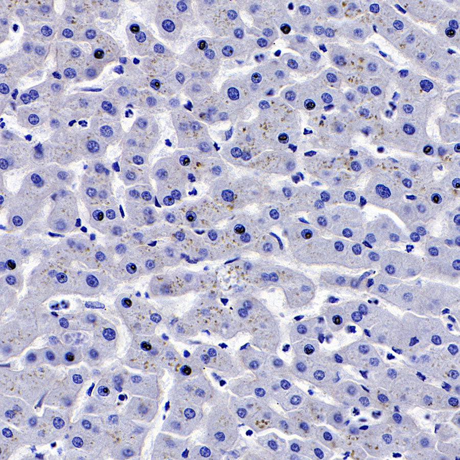 Glypican-3 Recombinant Rabbit mAb,PBS Only (SDT-R032)