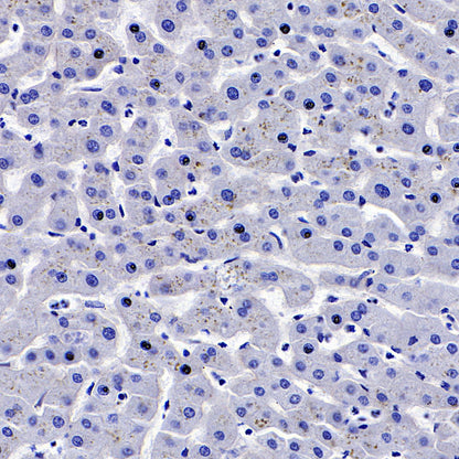 Glypican-3 Recombinant Rabbit mAb,PBS Only (SDT-R032)