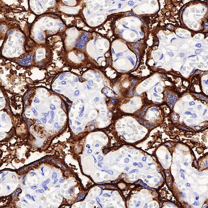 PLAP+ALPI Recombinant Rabbit mAb (SDT-167-155)