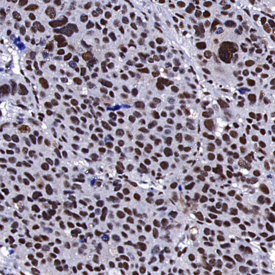RPA3 Recombinant Rabbit mAb (S-4552-20)