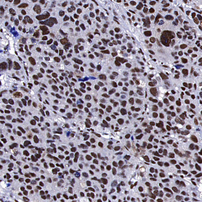 RPA3 Recombinant Rabbit mAb (S-4552-20)