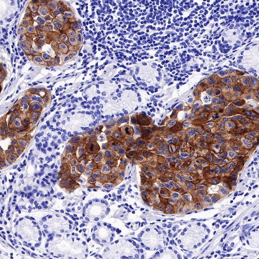 FGFR2b Recombinant Rabbit mAb (SDT-423-18)
