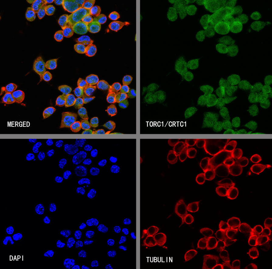TORC1/CRTC1 Recombinant Rabbit mAb (S-3978-42)