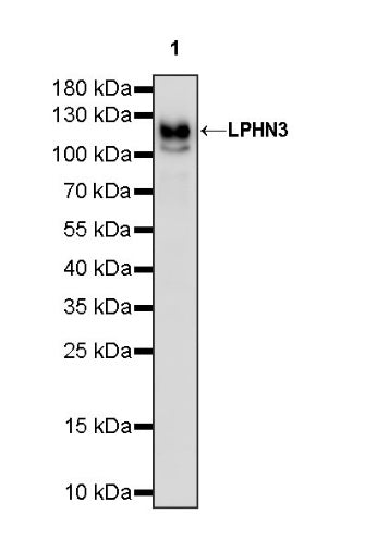 LPHN3 Recombinant Rabbit mAb (S-1594-72)