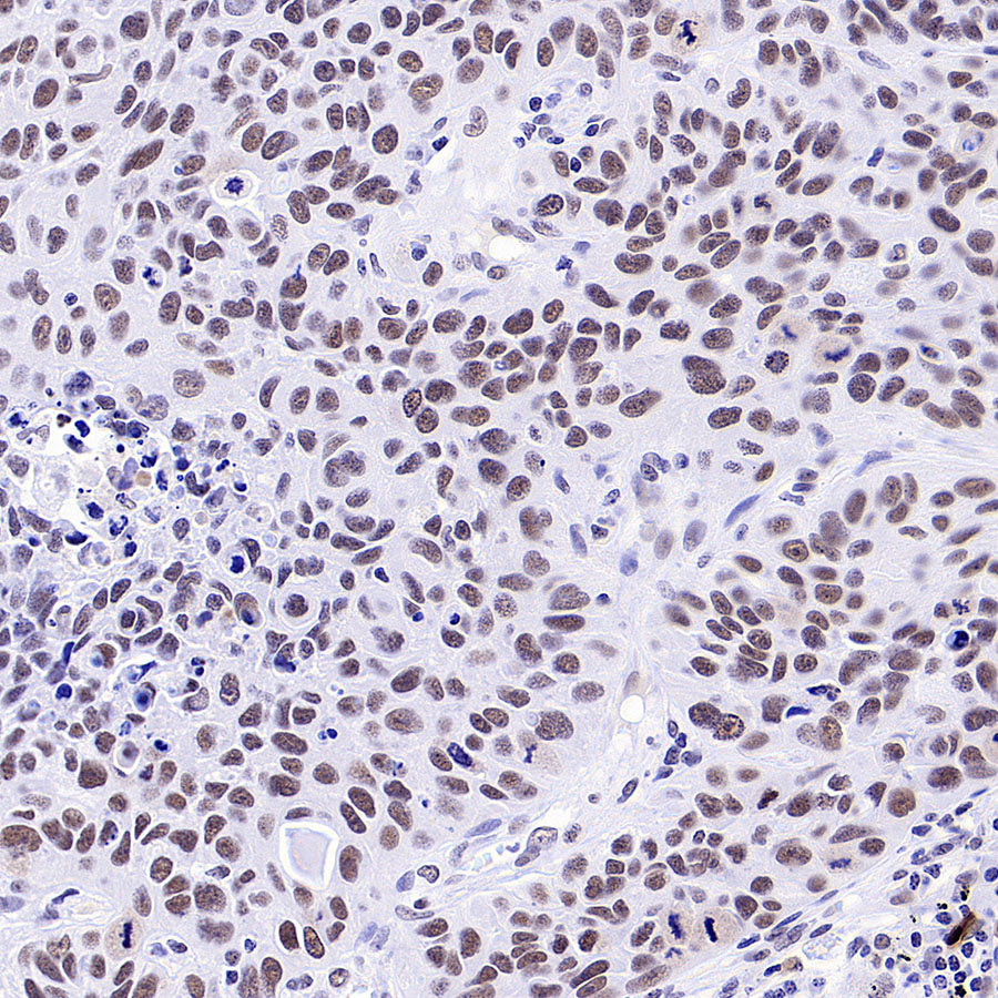 INI-1/SMARCB1 Recombinant Rabbit mAb (S-4068-21)