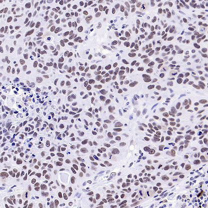 INI-1/SMARCB1 Recombinant Rabbit mAb (S-4068-21)