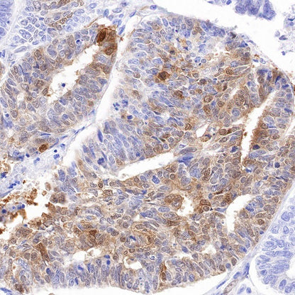 UCHL1 Recombinant Rabbit mAb (S-1765-38)