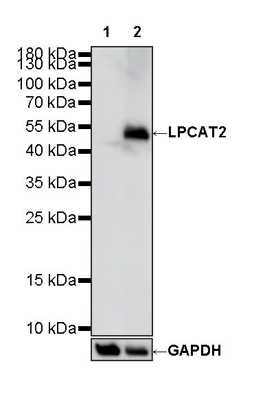 LPCAT2 Recombinant Rabbit mAb (S-4239-18)