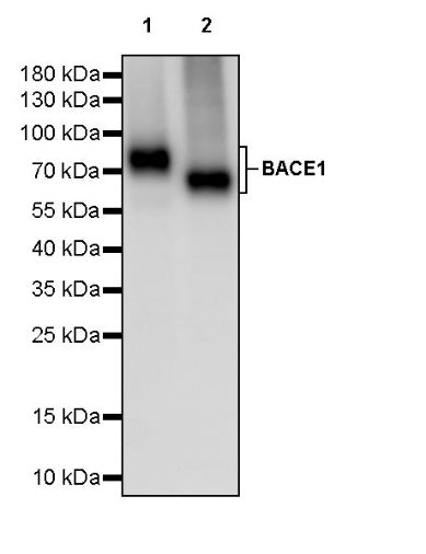 BACE1 Recombinant Rabbit mAb (S-2514-34)