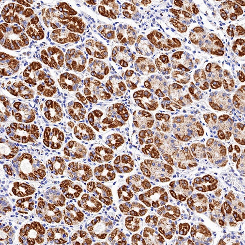 ATP5B Recombinant Rabbit mAb (S-1271-29)