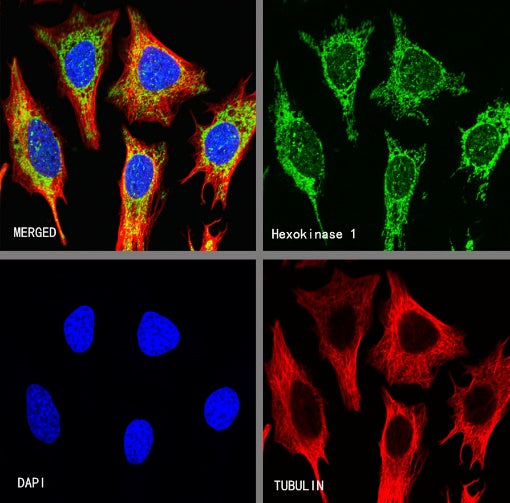 HexokinaseⅠRecombinant Rabbit mAb (S-868-113)