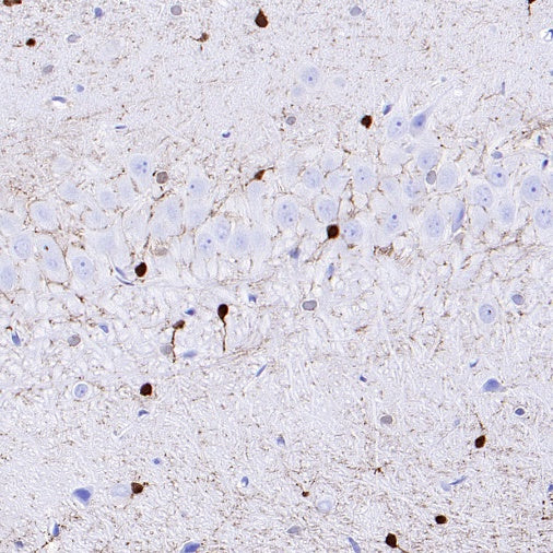 CA2 Rabbit Polyclonal Antibody
