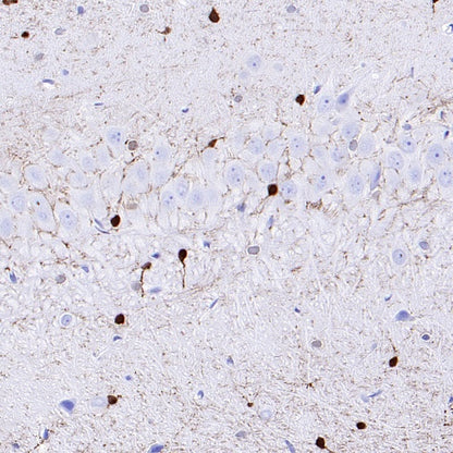 CA2 Rabbit Polyclonal Antibody