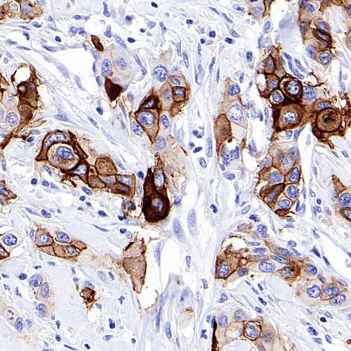 PLAP+ALPI Recombinant Rabbit mAb (SDT-167-155)