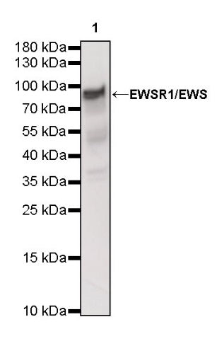 EWSR1/EWS Recombinant Rat mAb (S-R201)