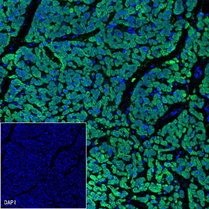 Cardiac Troponin I Recombinant Rabbit mAb (S-1352-15)