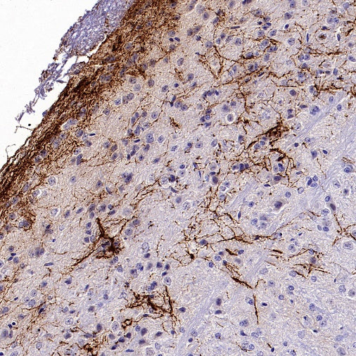 CGRP Recombinant Rabbit mAb (S-2490-74)