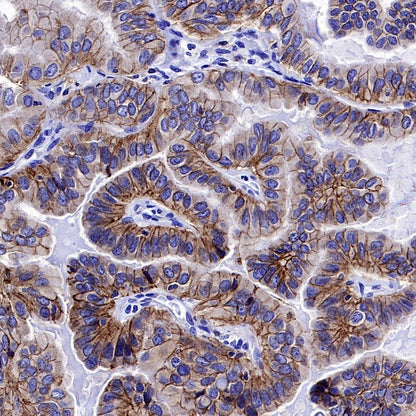 S-RMab® EpCAM Recombinant Rabbit mAb (SDT-078-128)