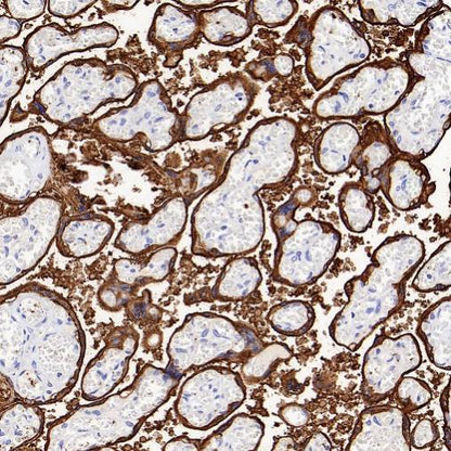 ALPP/ALPPL2 Recombinant Rabbit mAb (S-2089-36)