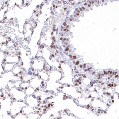 p27 Recombinant Rabbit mAb (S-141-135)