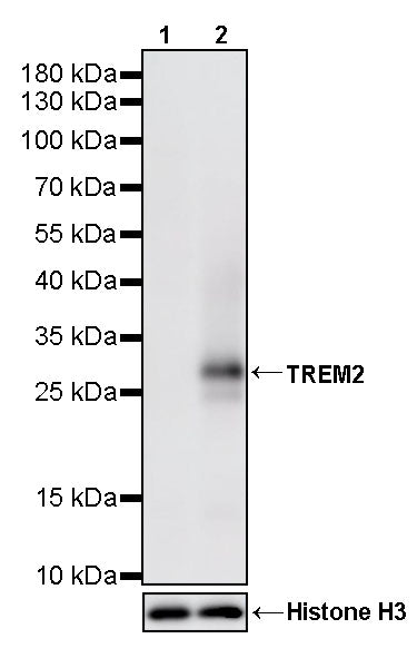 TREM2 Recombinant Rabbit mAb (S-5570)