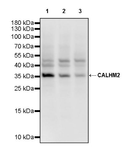 CALHM2 Recombinant Rabbit mAb (S-2671-146)