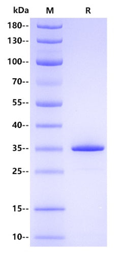 Human PTP1B Protein, His tag