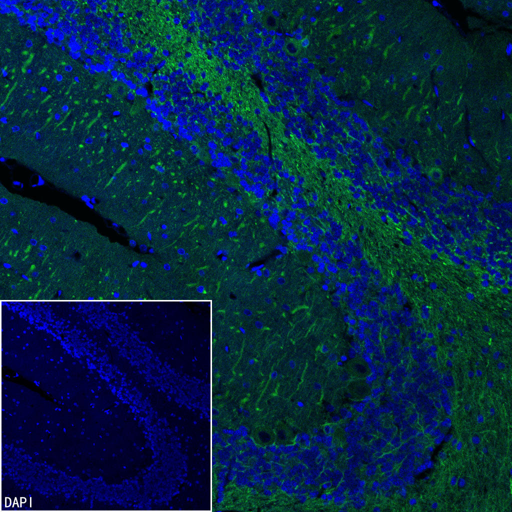 Beta III tubulin Recombinant Rabbit mAb (Alexa Fluor® 488 Conjugate) (SDT-251-28)