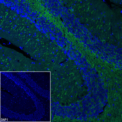 Beta III tubulin Recombinant Rabbit mAb (Alexa Fluor® 488 Conjugate) (SDT-251-28)
