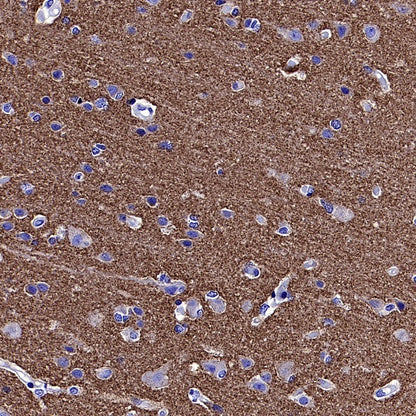 VAMP2 Recombinant Rabbit mAb (S-2359-2)