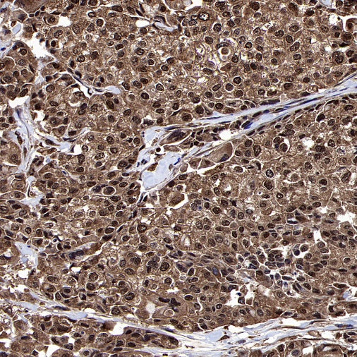 Erk1/2 Recombinant Rabbit mAb (S-3178)
