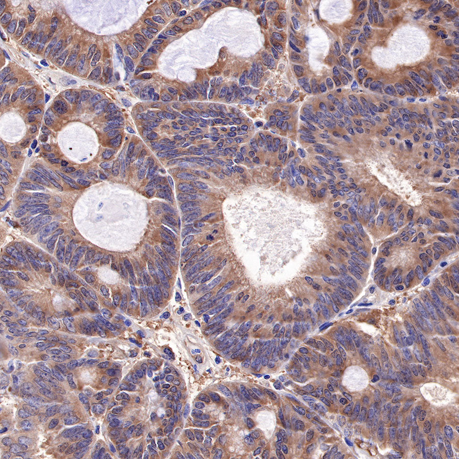 Hsp90 beta Recombinant Rabbit mAb (SDT-359-59)
