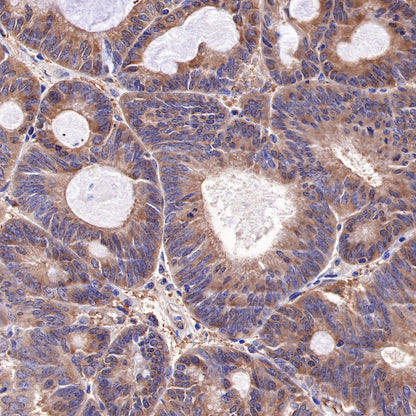 Hsp90 beta Recombinant Rabbit mAb (SDT-359-59)