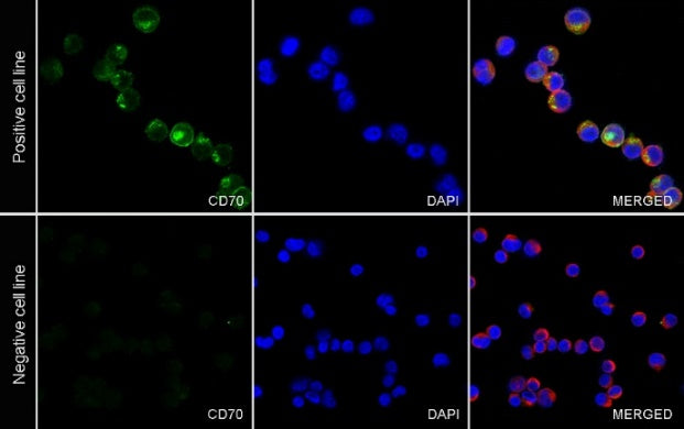 CD70 Recombinant Rabbit mAb (S-1725-277)