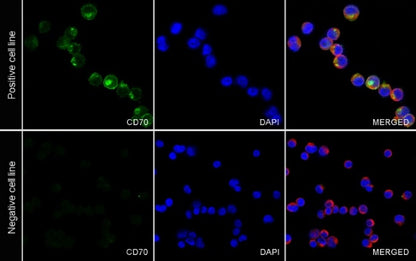 CD70 Recombinant Rabbit mAb (S-1725-277)